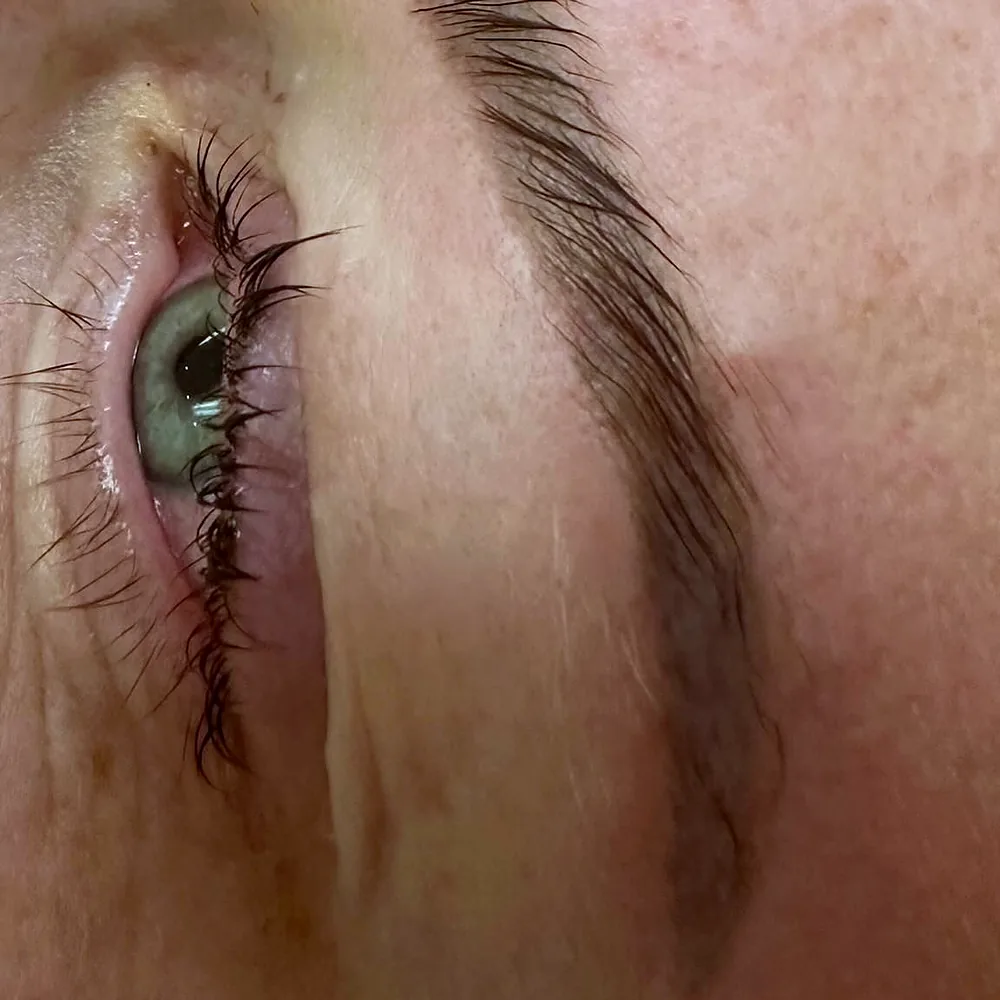 Wimpern und Brauen nach dem Lifting