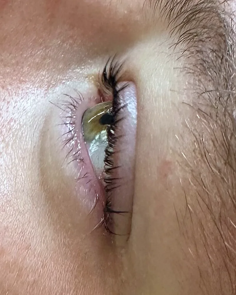 Wimpernlifting in der Seitenansicht